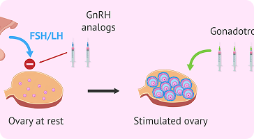 Ovarian Stimulation Protocols